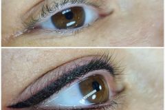 eye10