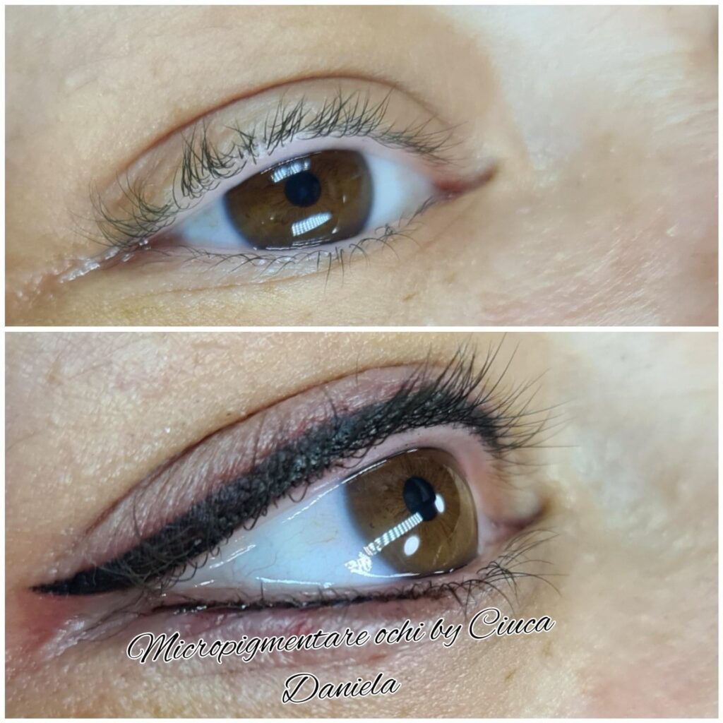 eye10