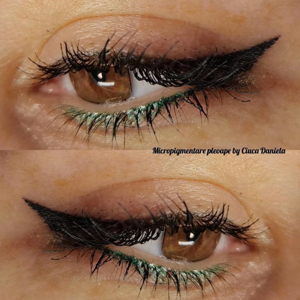 eye7